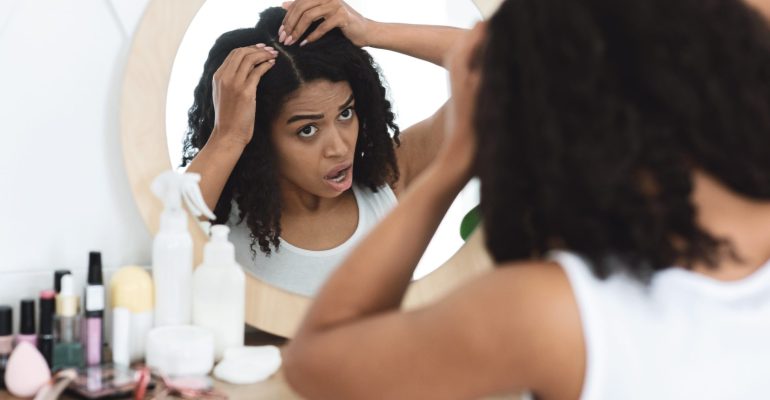 Natural remedies for hair loss